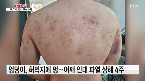 [단독] 해군 병사 피투성이 만든 \