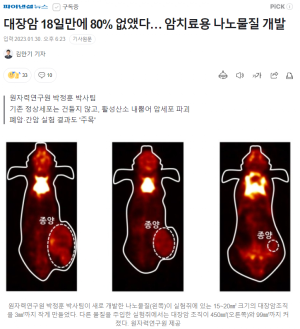 image.png 대장암 18일만에 80% 없앴다